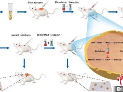 專家發現骨關節術后感染防治新策略：傳統藥物對抗超級耐藥菌“顯身手”