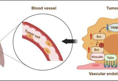 學者發現常用靜脈麻醉藥丙泊酚或增加腫瘤侵襲、轉移風險