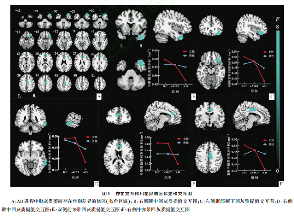 男女有別：患上阿爾茲海默癥后，女性活得更難！