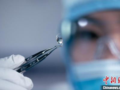 國(guó)家重點(diǎn)研發(fā)計(jì)劃項(xiàng)目新一代人工晶狀體進(jìn)入臨床階段