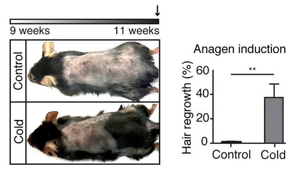 禿頭有救啦!一身雞皮疙瘩竟與生發有關,禿頭青年必看-易網健康養生網 禿頭有救啦!一身雞皮疙瘩竟與生發有關,禿頭青年必看