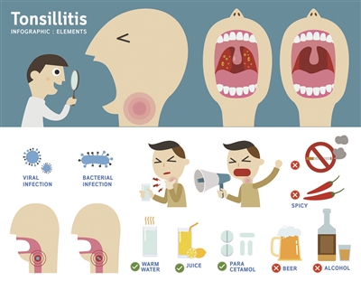 夜深人靜咳咳咳竟是胃在“搗鬼”
