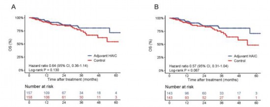 廣東團隊證實新型化療方案可降低肝細胞癌患者術后復發風險