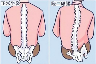 不良體態正悄悄損害你的健康（服務窗）