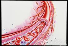 忽視6個細節，血管早晚堵