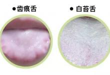 每天蒸飯放一把，遠(yuǎn)離三高、心臟病、拒絕癌癥