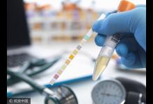 小便后看一眼就能保命，這種顏色是大病征兆