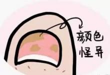 茄子這樣吃，勝過10副藥