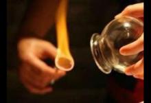 拔罐常用體位有4種 操作時(shí)需注意這些