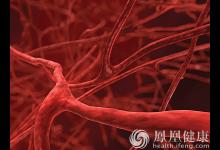 5個身體癥狀，暗示血脂“超標”，需警惕！