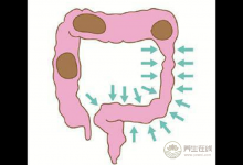 食療養生：常吃這些食物能養胃
