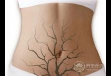 熊畫(huà)健康：國(guó)民好老公讓她沒(méi)有發(fā)“炎”權(quán)