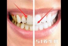 刷牙到底用熱水還是冷水好？搞錯這一點，難怪天天刷牙還是大黃牙