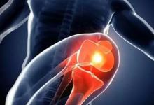 膝關節為什么會發出彈響？