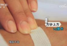輸液后按壓方法不當 易造成手背淤青！
