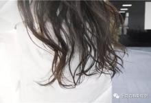 脫發嚴重怎么辦?怎樣做,才可以緩解脫發?