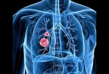 長期吃梨有潤肺止咳的功效嗎？