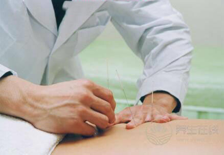 針灸減肥有效嗎針灸減肥有關的知識