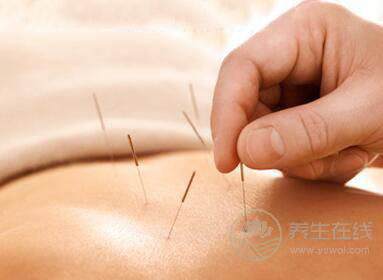 針灸減肥有效嗎針灸減肥有關的知識