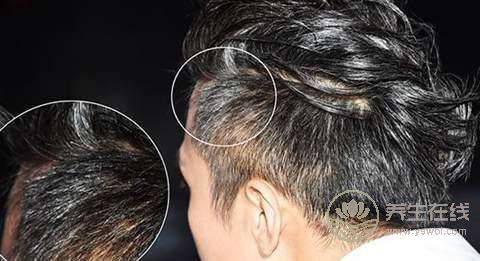 食療治白發 飲食均衡是關鍵