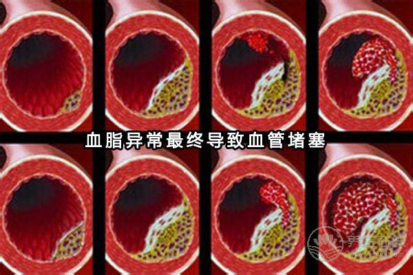 患高血脂人群越來越多，多吃這6種食物可以有效預(yù)防