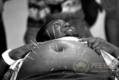 針灸養(yǎng)生 針灸減肥原理及注意事項