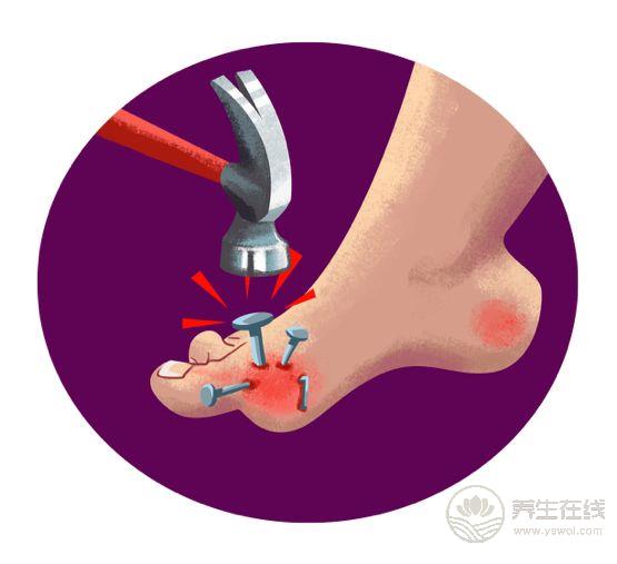 尿酸高的人注意，這3類食物碰多了，腎會“壞掉”！