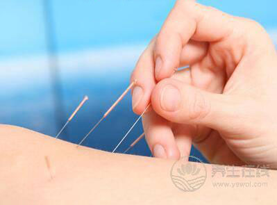 針灸減肥有效嗎針灸減肥有關的知識