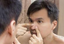 假期飲食不當竟會惹上皮膚病？節(jié)后調(diào)理身體需注意4點