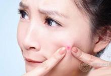 臉上長(zhǎng)痘痘吃什么好？