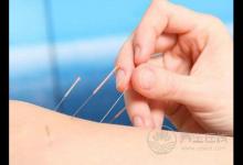 針灸減肥有效嗎針灸減肥有關(guān)的知識