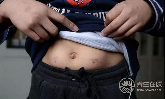 一段簡單的降糖經歷，用樹葉泡水喝，花錢少效果好