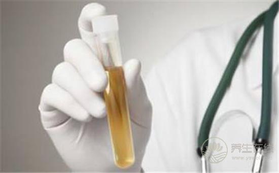 尿液發(fā)黃像濃茶？小心是肝膽出了問題！