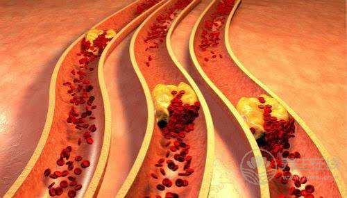 這些清理血管的特效食物，35歲以后一定要多吃