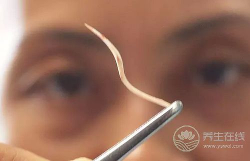 被魚刺卡了，吃飯團喝醋？錯！