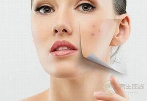 痘痘星人看過來，這3種食物咱別吃了，再好吃為了美也要忍