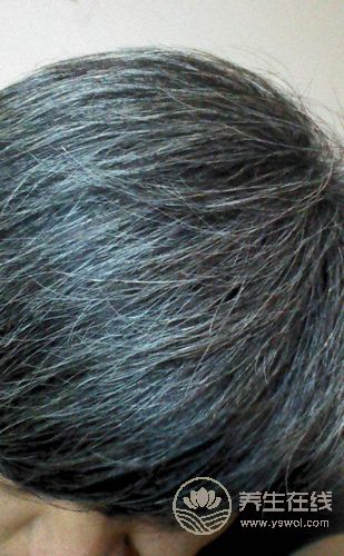 想要白發變黑發，需要做好5點