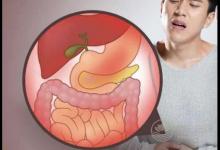 洗牙之后注意事項有哪些？