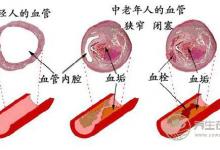 泡腳水加點姜，能有想不到的功效