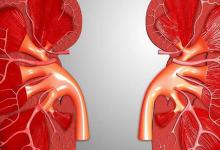 補血補氣的食物有哪些？