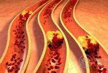 這5種食物堪稱“血管清道夫”，血管垃圾一掃空