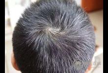 早生華發(fā)，試試枸杞，能幫你找回黑發(fā)