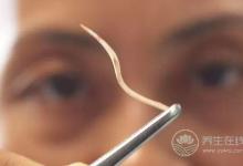  被魚刺卡了，吃飯團喝醋？錯！