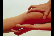 半夜小腿抽筋別以為是小事，真相往往令人驚呆了！