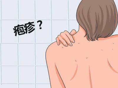 嘴上長皰疹怎么樣治療恢復的更快