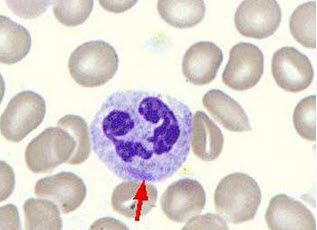 吃什么食物可以讓白細(xì)胞更快的增殖