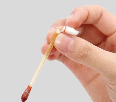 當身體出現傷口可以用碘伏消毒嗎