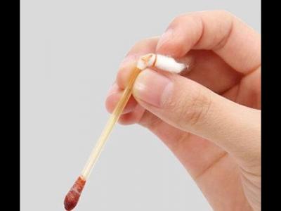 當身體出現傷口可以用碘伏消毒嗎