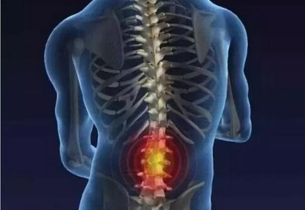 檢查腰椎是否健康要檢查哪些方面