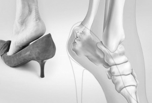 滑囊炎分為哪幾種要怎樣做好消炎的工作 滑囊炎分為哪幾種要怎樣做好消炎的工作